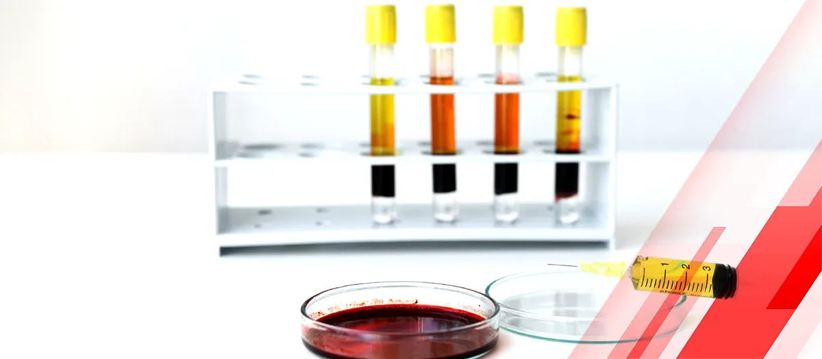 Top 10 Latex Agglutination Test Kits Companies: A Comprehensive Guide